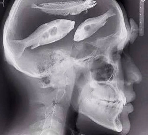 Actual x-ray of the skull area of a FishHead